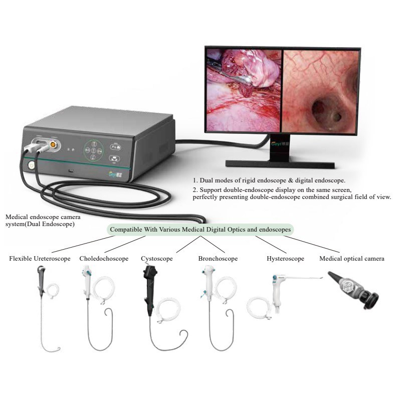 Portable Endoscope System Portable Endoscope System