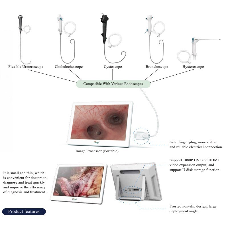 Medical Endoscope Monitor